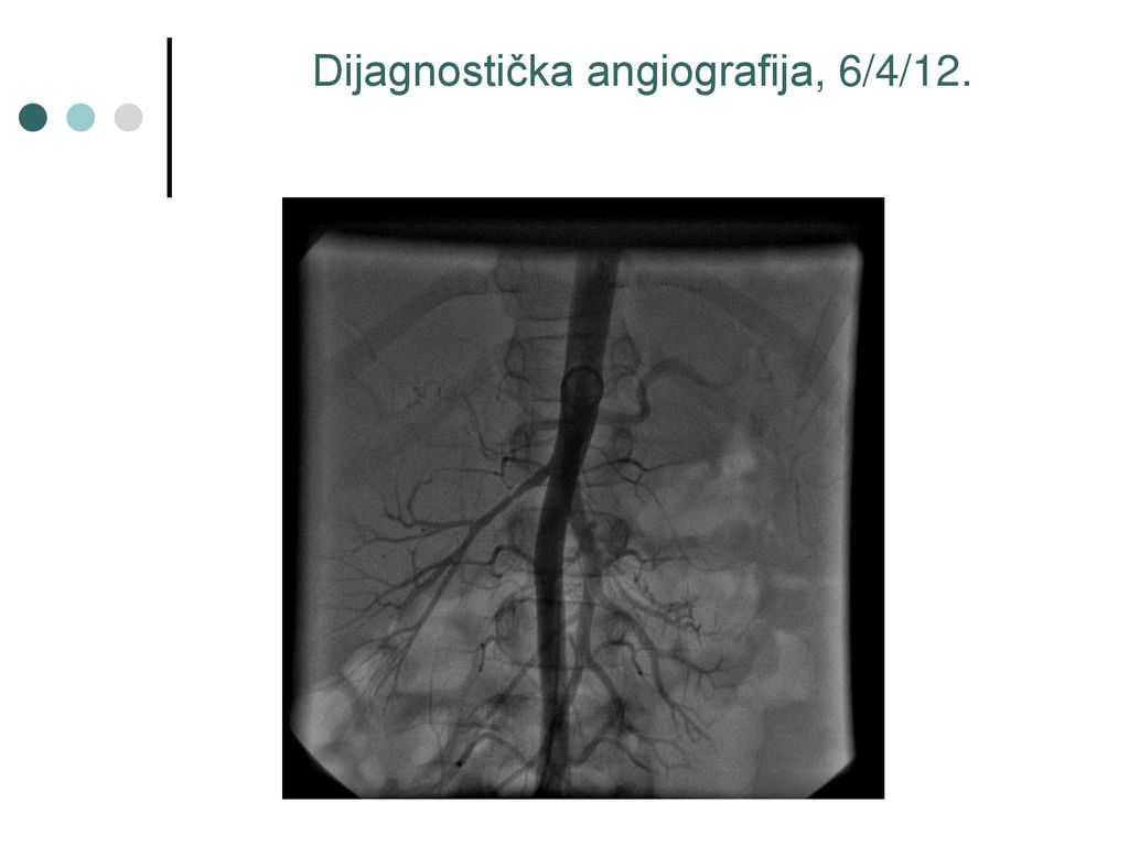 hipertenzija angiografija)